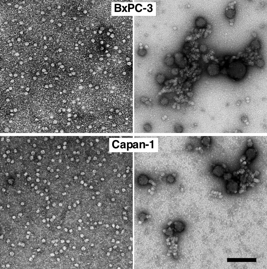 exosomes pancreatic cancer